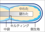 ダニゼロックの断面図、表面の針穴をなくした特殊製法